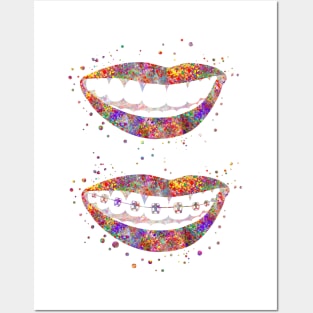 Teeth braces Posters and Art